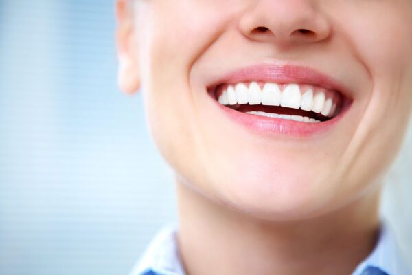 Teeth Whitening Louisville