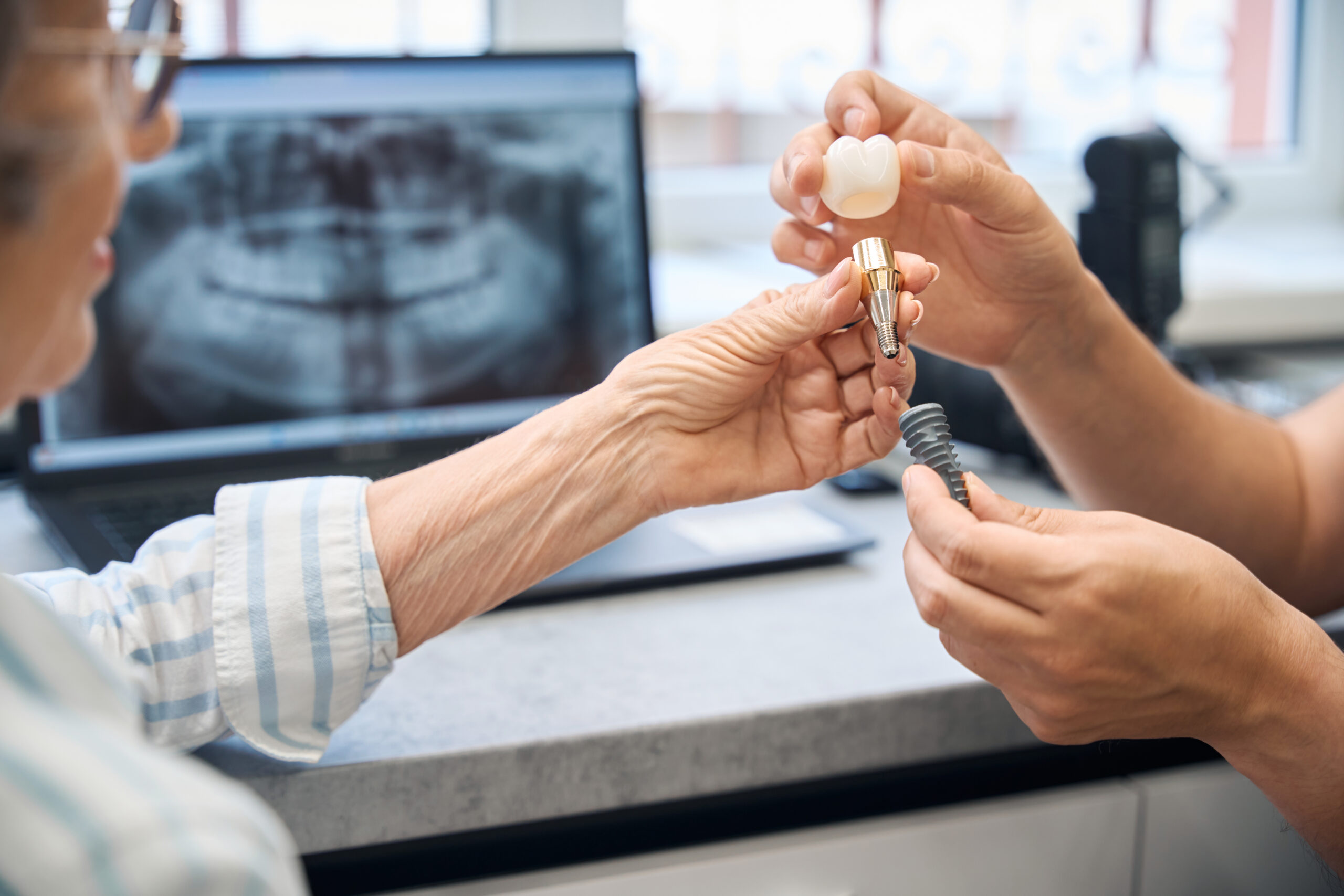 Dental Implants Louisville, KY