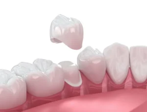 Why We Built a Dental Lab in Our Office in Louisville, KY