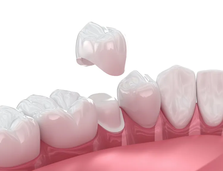 Why We Built a Dental Lab in Our Office in Louisville, KY